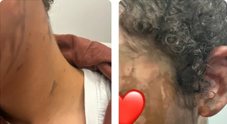 Pictures of seemingly burned skin