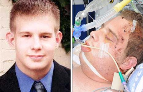 David Baker before and after the attack that left him in a coma