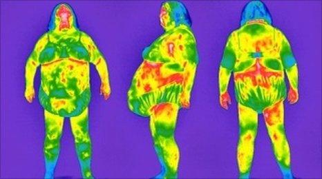 Thermograms of an obese woman. Pic Tony McConnell/SPL