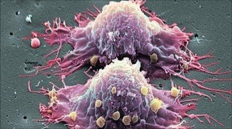 Cancer cell