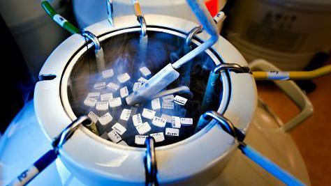 Hand retracting frozen sperm specimen used in invitro fertilization. - stock photo