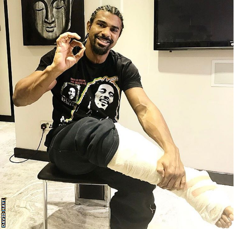 Haye with his leg in a bandage