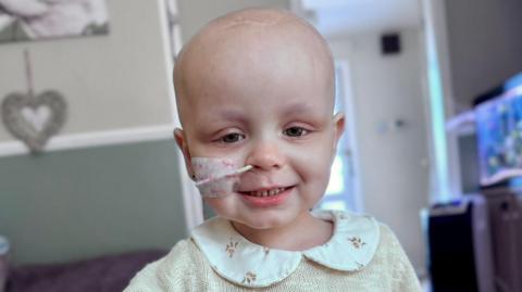 A two-year-old girl with a hospital tube through her nose.