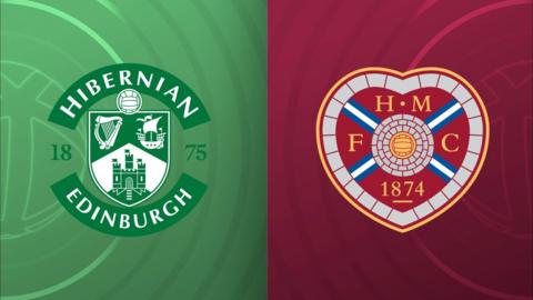 Hibernian and Hearts badges