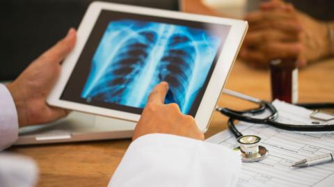 A chest X-ray displayed on a table, with a person holding the tablet and pointing to the X-ray. A stethoscope, pen and chart on the table. A person's hands clasped in the background.