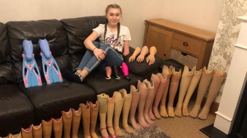 Olivia Story as a child sitting on a black sofa and smiling with her legs up. On the floor in front of her are a series of prosthetic legs lined up. There is a chest of drawers in the corner of the photo. Story has ponytails and brown hair. 