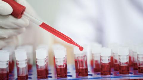 A close-up view of a gloved hand holding a dropper filled with red liquid above several laboratory vials, with a blurred clinical setting in the background.
