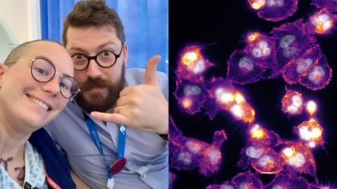 There are two images side by side. In the left image is a close-up shot of a man and a woman smiling at the camera. On the right is a scan showing purple shapes with yellow and white spots on a black background.