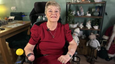 Kim Smith, a woman in her sixties with short fair hair, in an electric wheelchair. Her right hand has been amputated but she has a transplanted right hand.