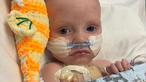 Macs Green is a small baby. He is lying in a hospital bed with a tube coming from his nose. He has an orange cuddly toy on his right