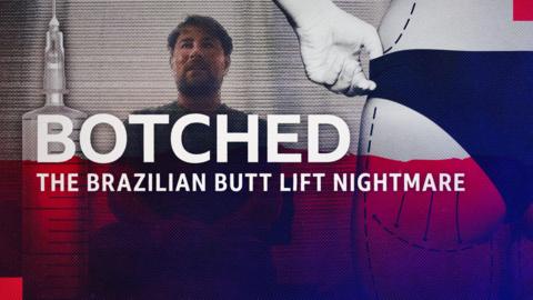 Botched: The Brazilian Butt Lift Nightmare