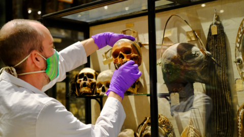 Skull being removed