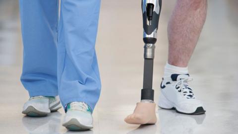 A stock image of two pairs of legs walking down a hallway. One person is wearing light blue medical scrubs and trainers, while the other has one prosthetic foot and a trainer on the other leg.