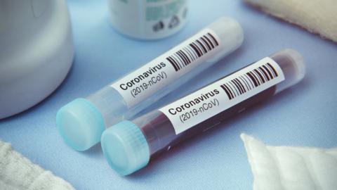 Coronavirus vials