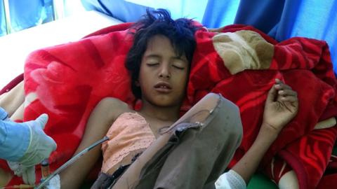 Boy injured in an air strike on a wedding party in northern Yemen is treated at a hospital in Hajja on a stretcher (23 April 2018)