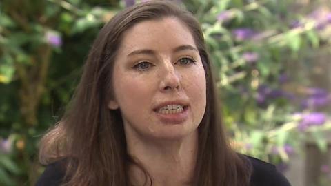 Catrin Pugh hopes to now help other burns survivors
