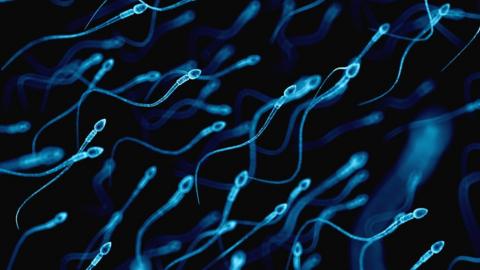 A file photo of sperm cells