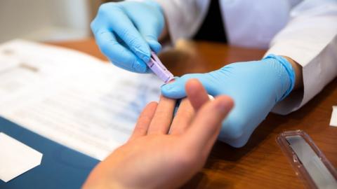 Patient getting a fingerprick test from a GP