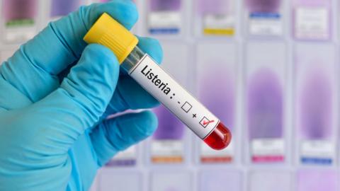 Blood sample tube positive with Listeria bacteria