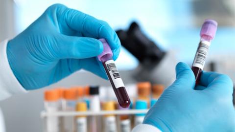 Tubes of blood samples in a laboratory