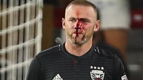 A bloodied Wayne Rooney