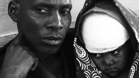 A man with a child in a bandage in DR Congo