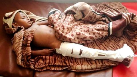 A child receives treatment at hospital in the town of Dedebit, in Ethiopia's northern region of Tigray