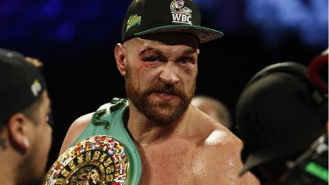 Tyson Fury