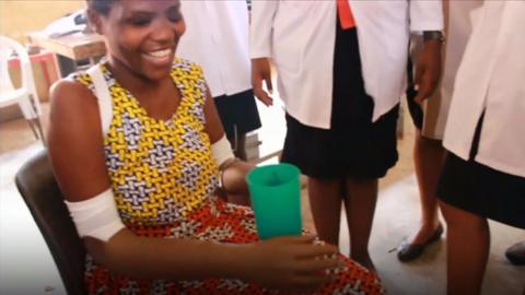 Ninsiima with prosthetic arms holding a cup