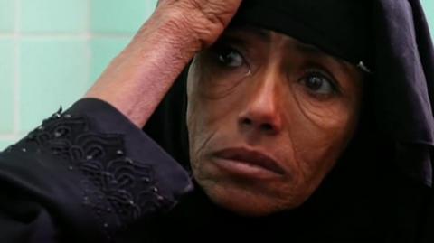 The United Nations is warning that 13 million people in Yemen are facing starvation.