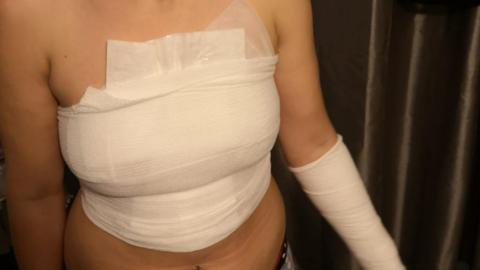 Stacey Andrew in bandages