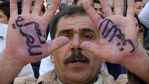 Anti-Syrian government protester, displays Arabic words on his hands, reading "Yes for freedom, no to violence" during a protest after Friday prayers in Damascus, Syria, Friday, March 25, 2011.