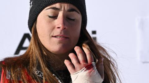 Sofia Goggia looks at her injured hand