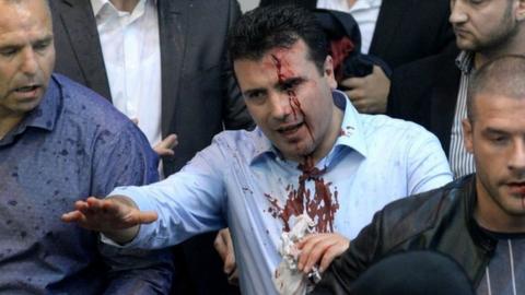 Social Democrat leader Zoran Zaev with blood pouring down his face