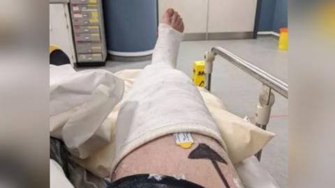 The victim spent Christmas in hospital with a broken leg in 2021