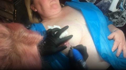 Tattoo artist tattooing a 3D nipple onto a client