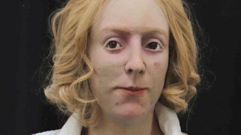 Bonnie Prince Charlie facial reconstruction