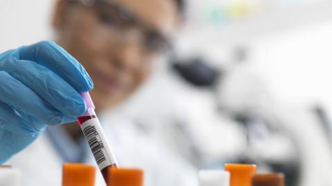 Female scientist about to view a human sample under a microscope - stock photo