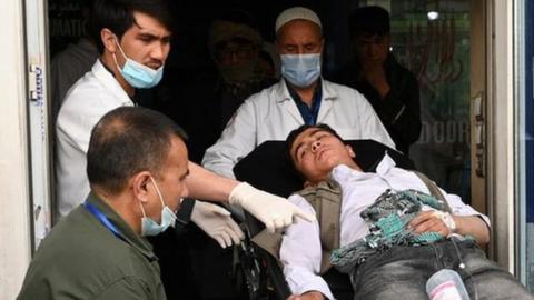 Medical staff move one of the wounded on a stretcher inside a hospital after blasts rocked a boys' school in a Hazara neighbourhood in Kabul on April 19, 2022.
