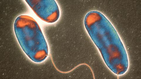 Legionella bacteria. Coloured transmission electron micrograph (TEM) of a section through Legionella pneumophila bacteria, the cause of Legionnaires' disease