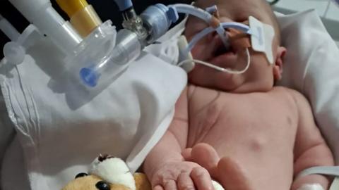 A small baby in a hospital bed