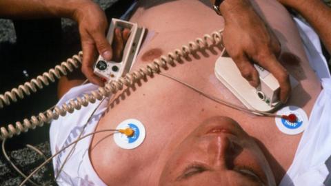 Man receiving defibrillator treatment