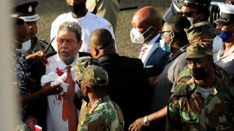 Ralph Gonsalves, his shirt covered in blood, is evacuated after being hit in the head by a stone