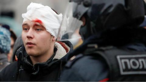 Protester in Moscow with bloodied bandage