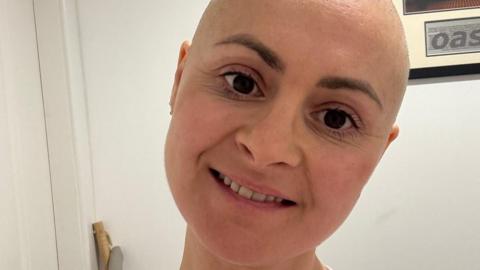 Jo smiles at the camera in a self-shot picture. She has no hair after chemotherapy and has dark eyes.