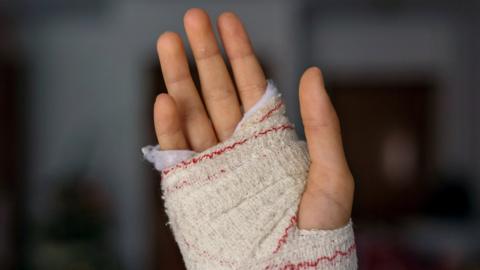 Stock image of child's bandaged hand