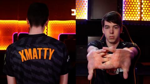 Matthew Coombs, an esports player, stretches his arms
