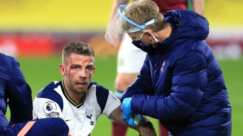 Toby Alderweireld has a head injury assessed by a Tottenham physio