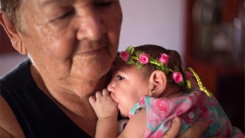 Ana Beatriz, a baby girl with microcephaly, celebrates her first fourth months of life in Lagoa do Carro, Pernambuco, Brazil, on 8 February 2016.