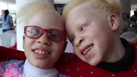 Children with Albinism smile, one wearing red glasses